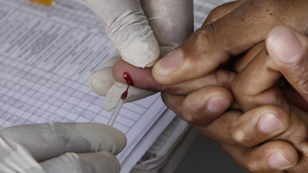 HIV test