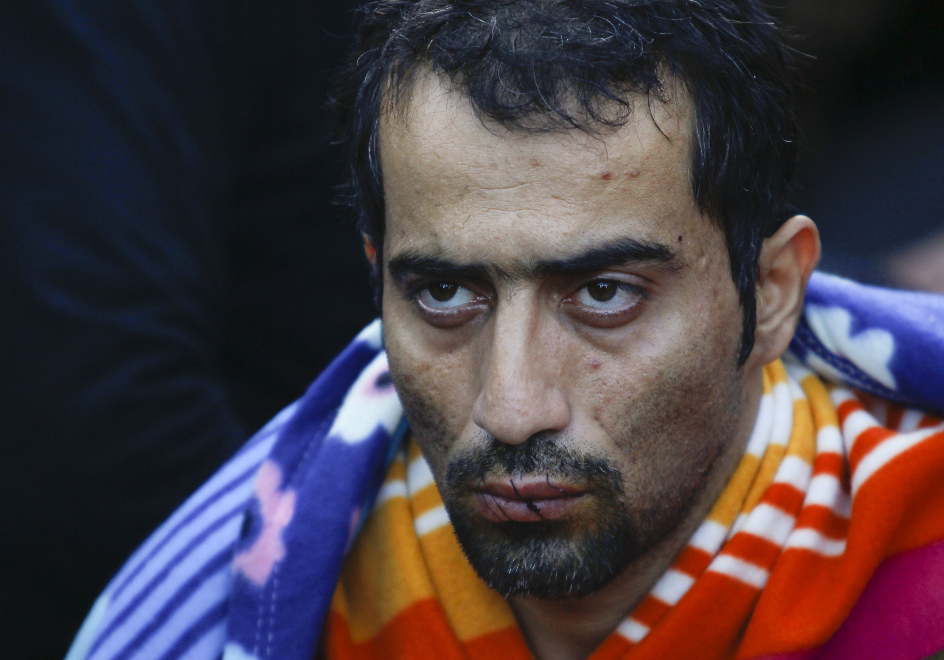 Refugees sew lips in Greece-Macedonia border protest