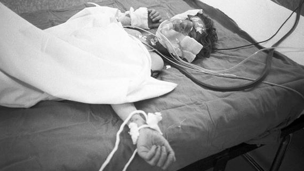 Halabja Victim