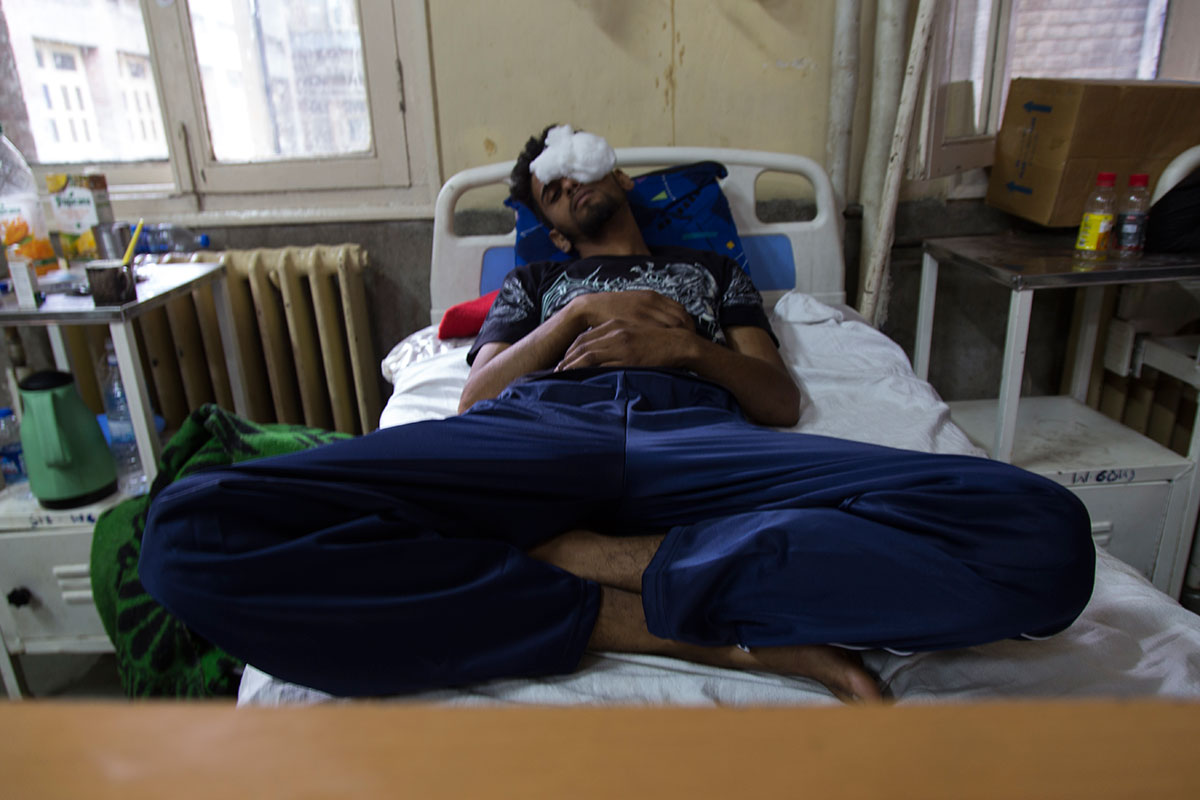 Pellet Injuries/ Please Do Not Use