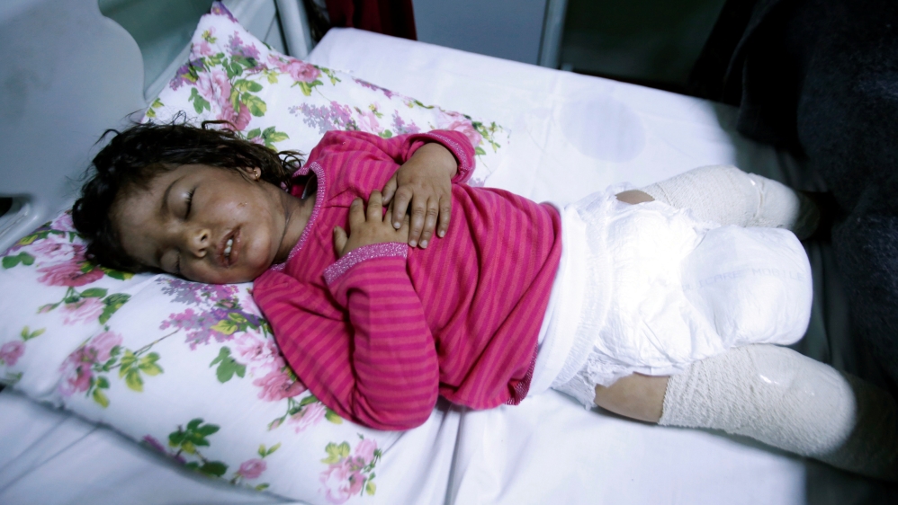 Dima Nadm Hamid, 3 years old is treated for possible exposure to chemical weapons agents in a hospital west of Erbilin Mosul