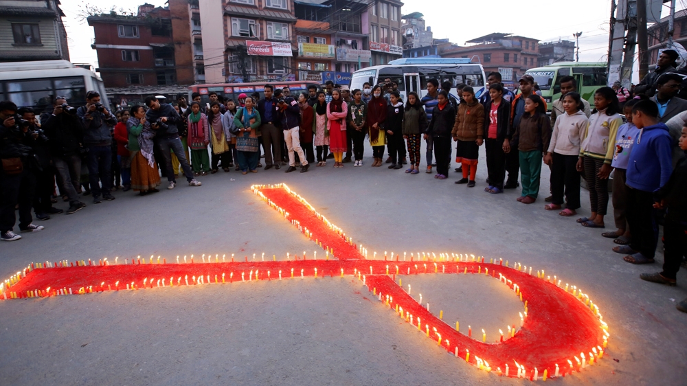 HIV AIDS