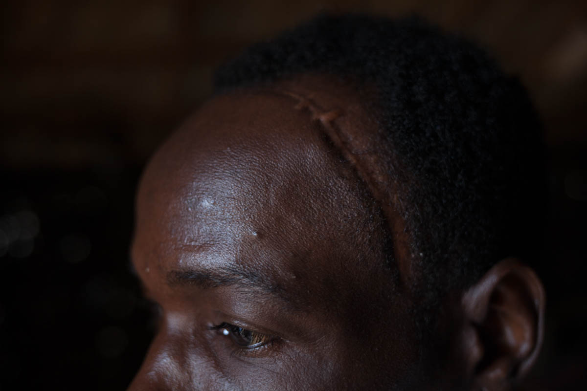 Central African Republic