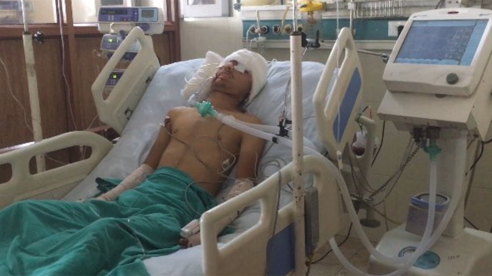 asrar khan kashmiri pellet victim