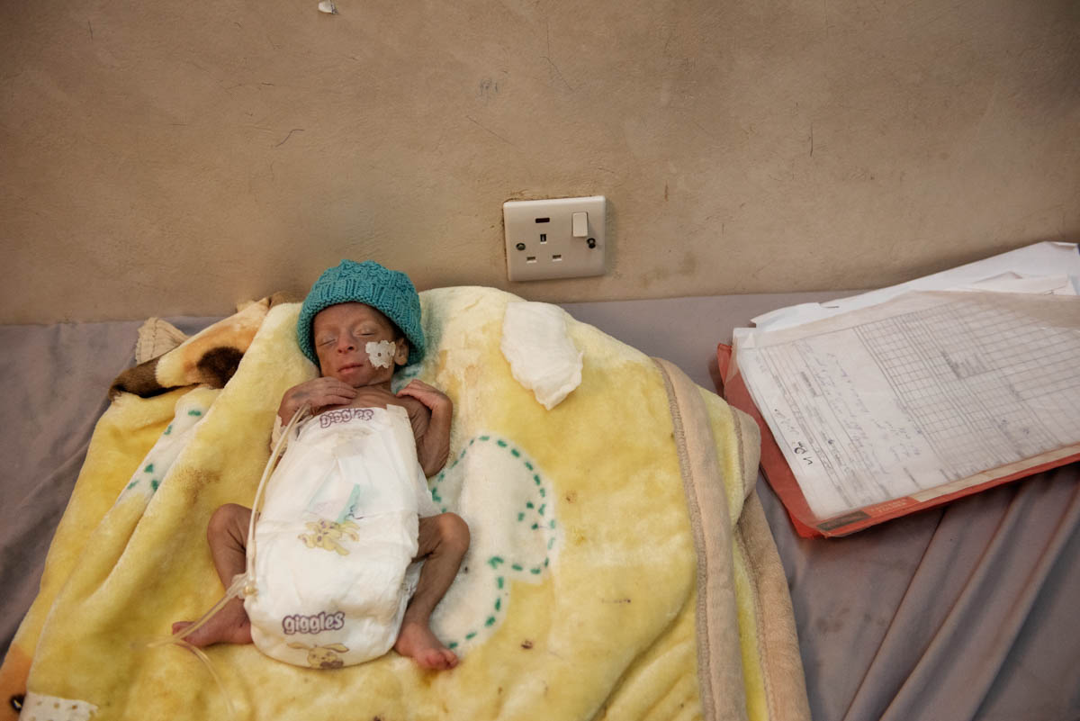 Province of Hajja, the areas most affected by malnutrition and cholera.