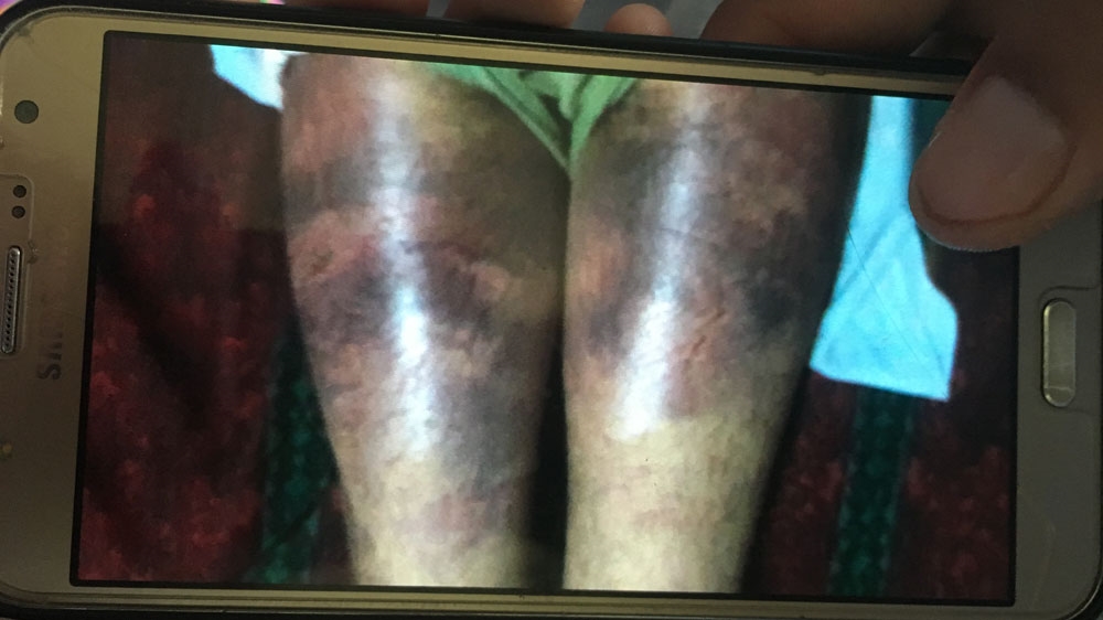 Kashmir torture