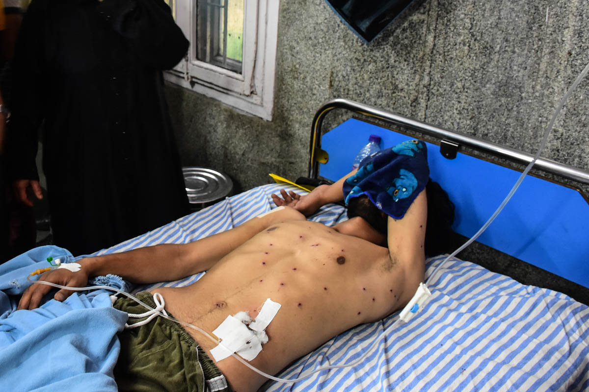 100 days of lockdown in Kashmir