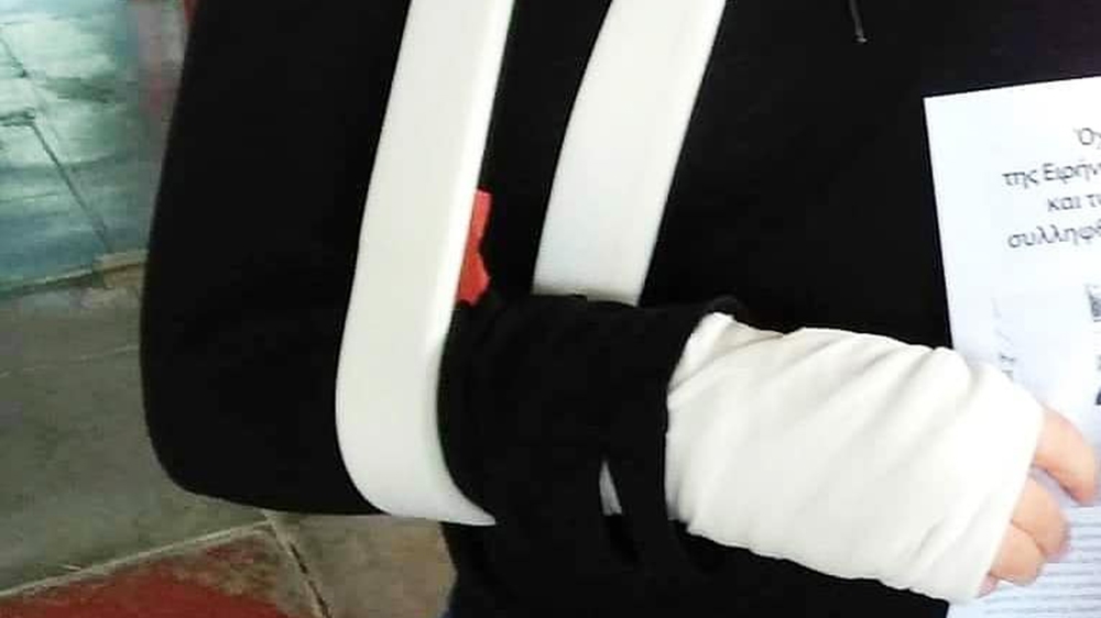 Irini’s arm was injured after an alleged attack by riot police following a protest on November 17 [Courtesy: Irini Eminidou]