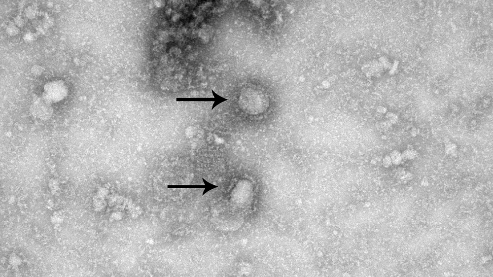 China virus