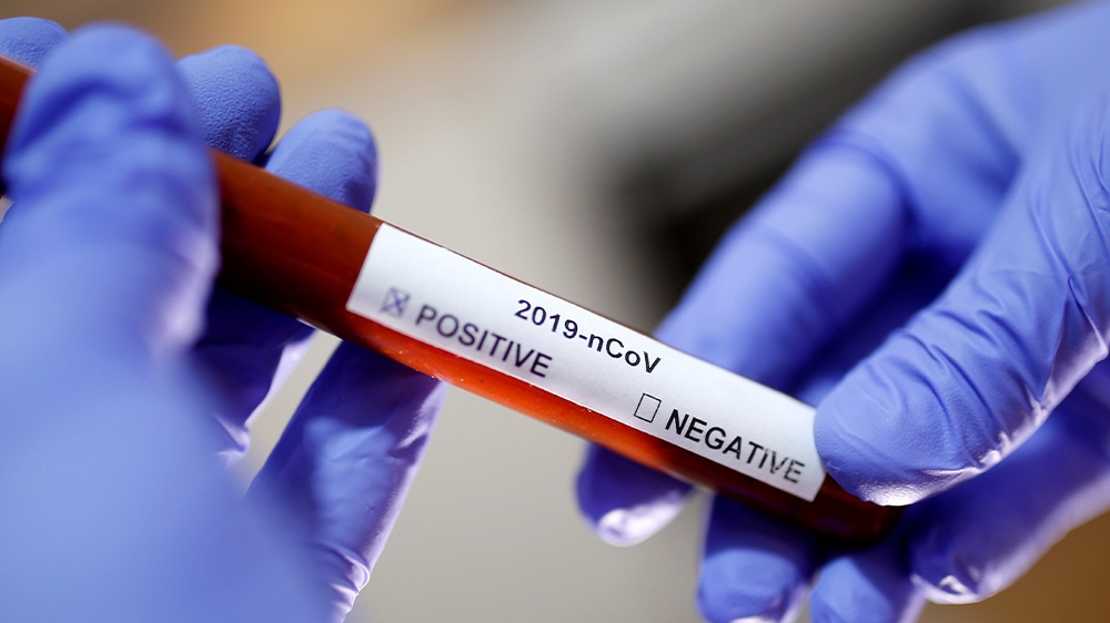 Coronavirus sample