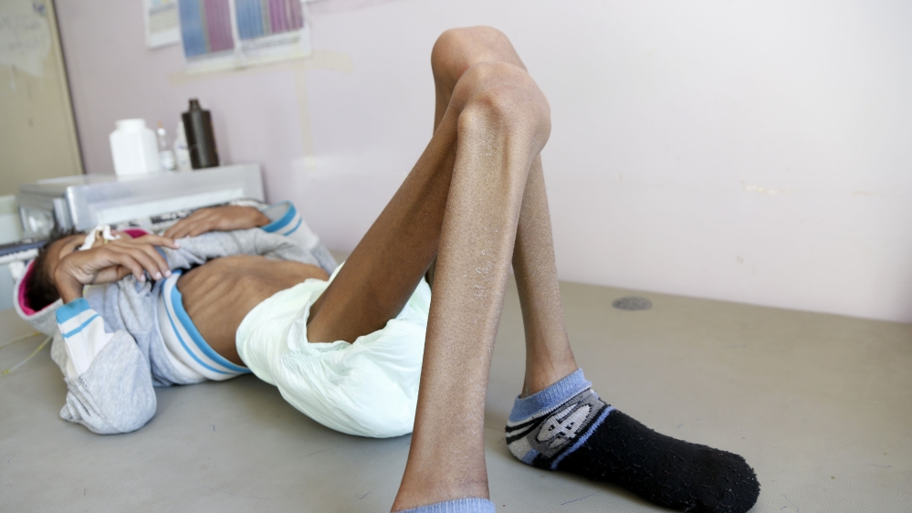 Humanitarian crisis increases day by day in Yemen