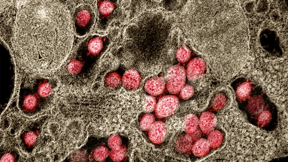 Coronavirus