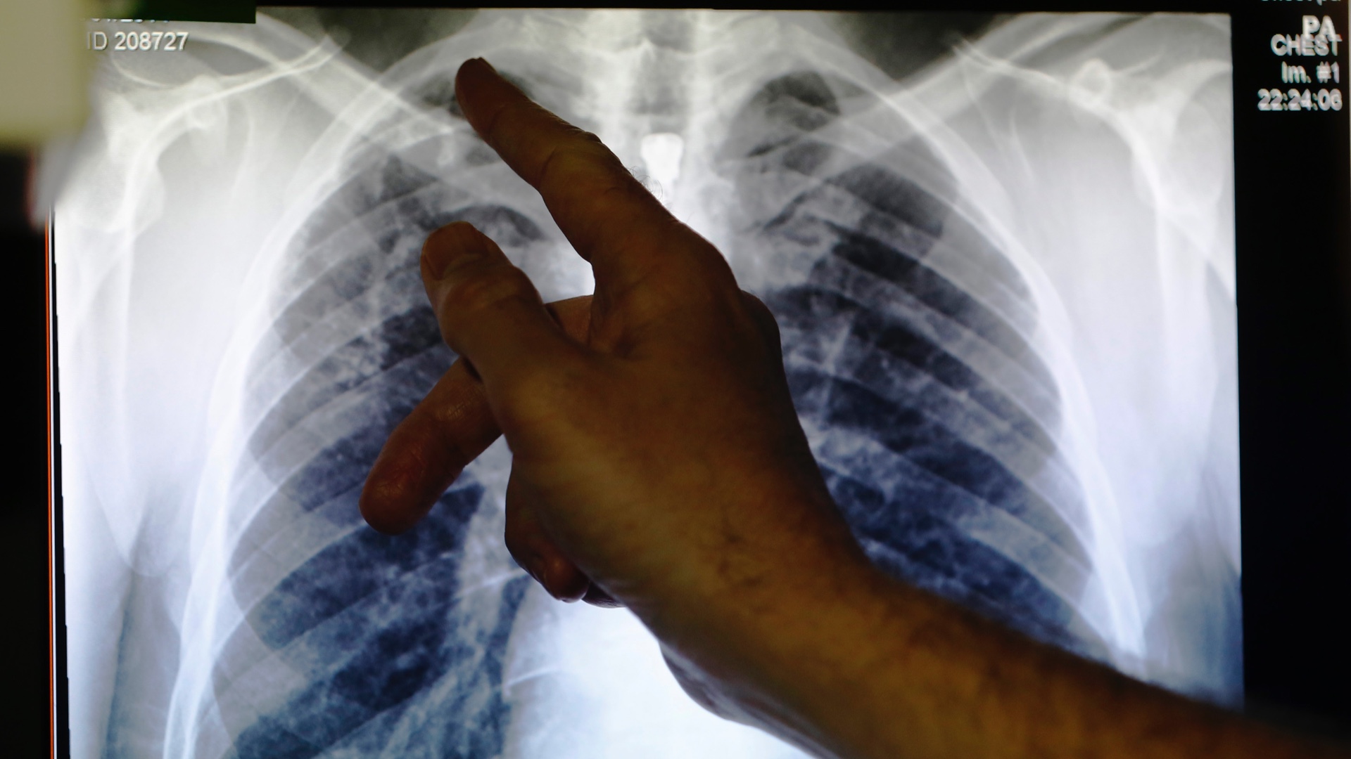 Doctor's note - x ray