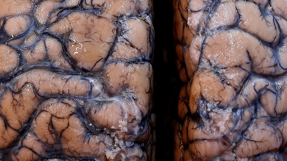 A brain