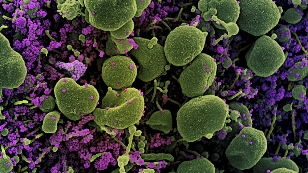 coronavirus