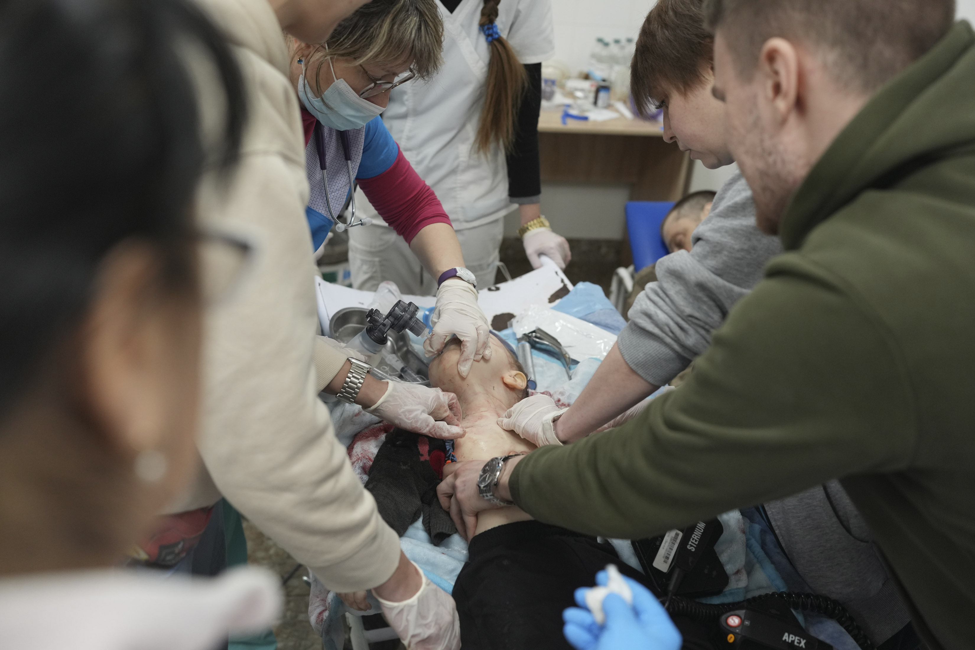 Medical workers unsuccessfully try to save the life of Marina Yatsko's 18 month-old son Kirill