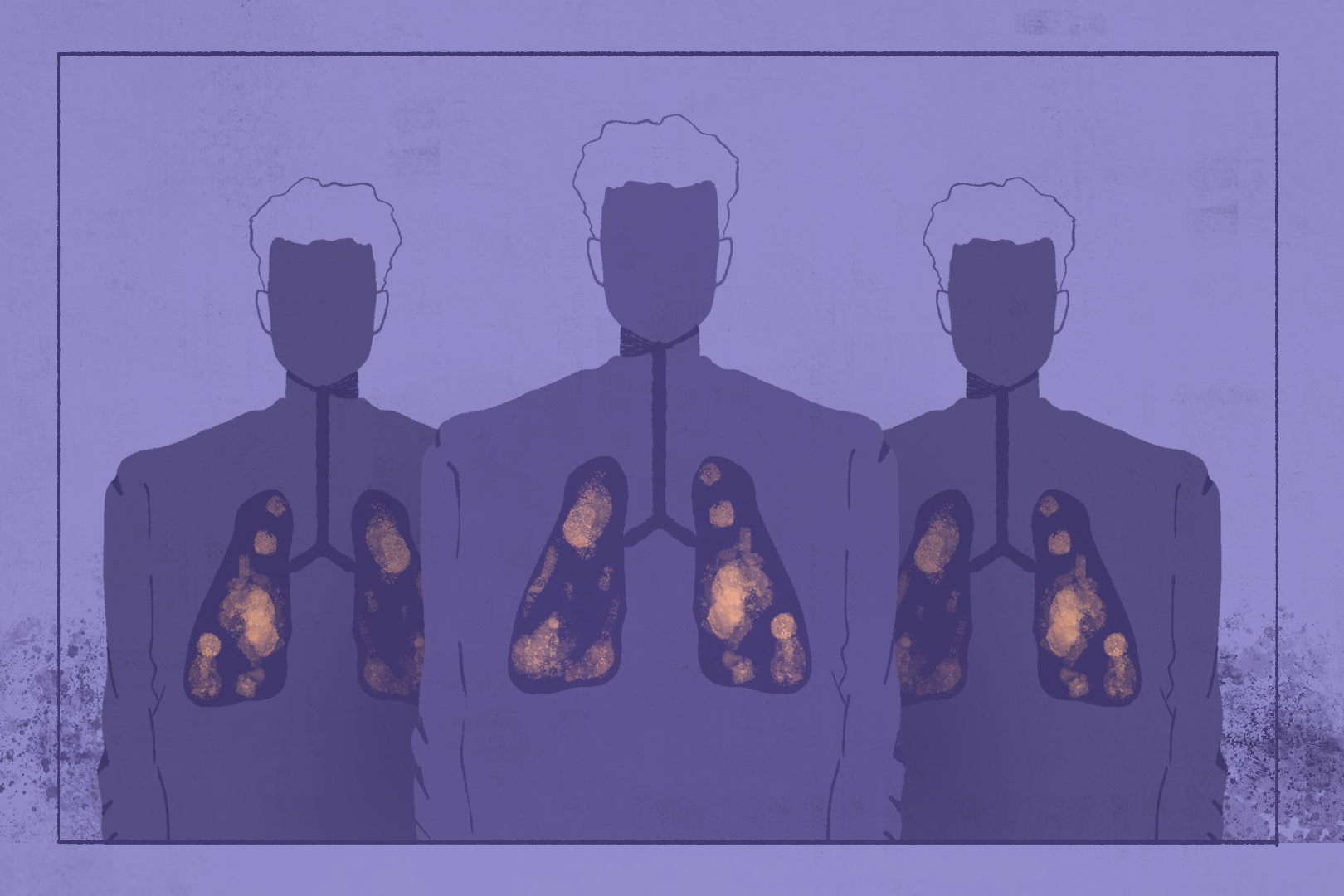 Drawing of lungs