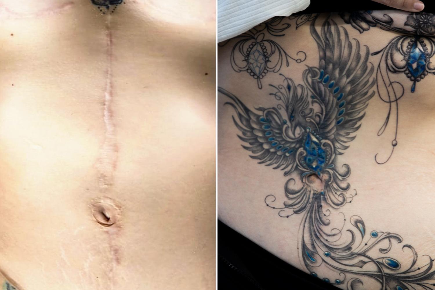 Helloany’s scars before her tattoo and after she got them covered up