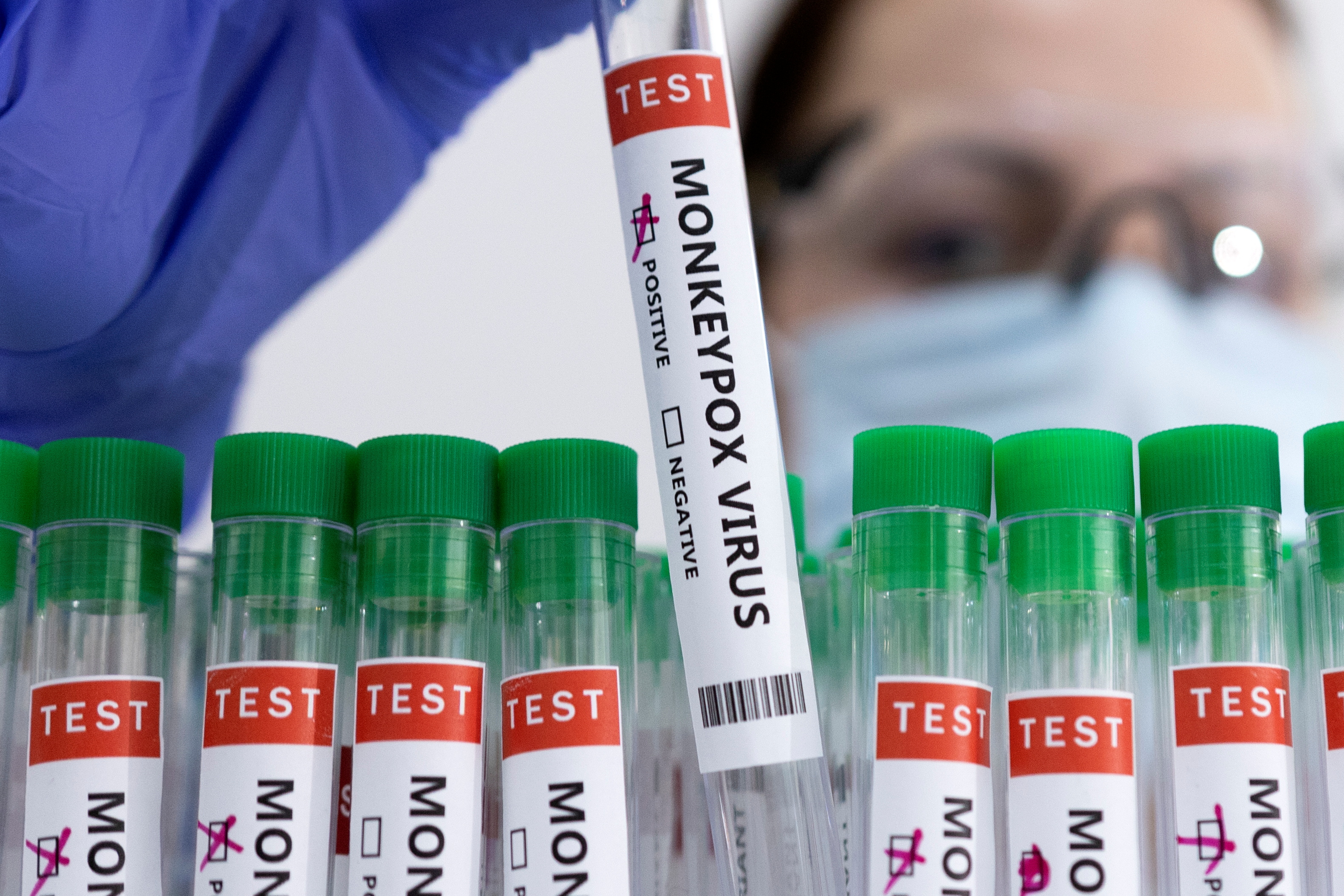 Vials of samples to be tested for monkey pox