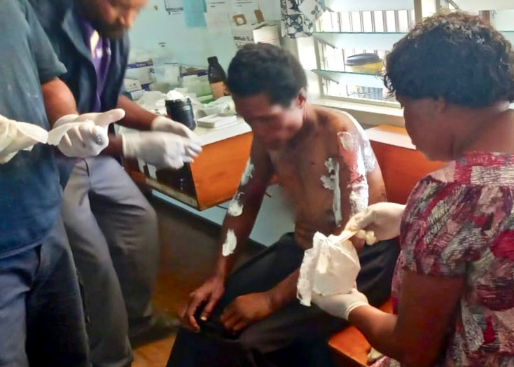 A victim of SARV receives medical treatment for their wounds