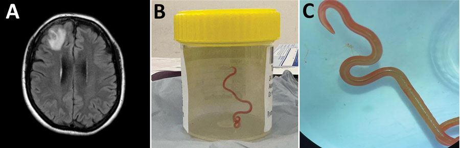 The worm in a specimen bottle. It's brown coloured.