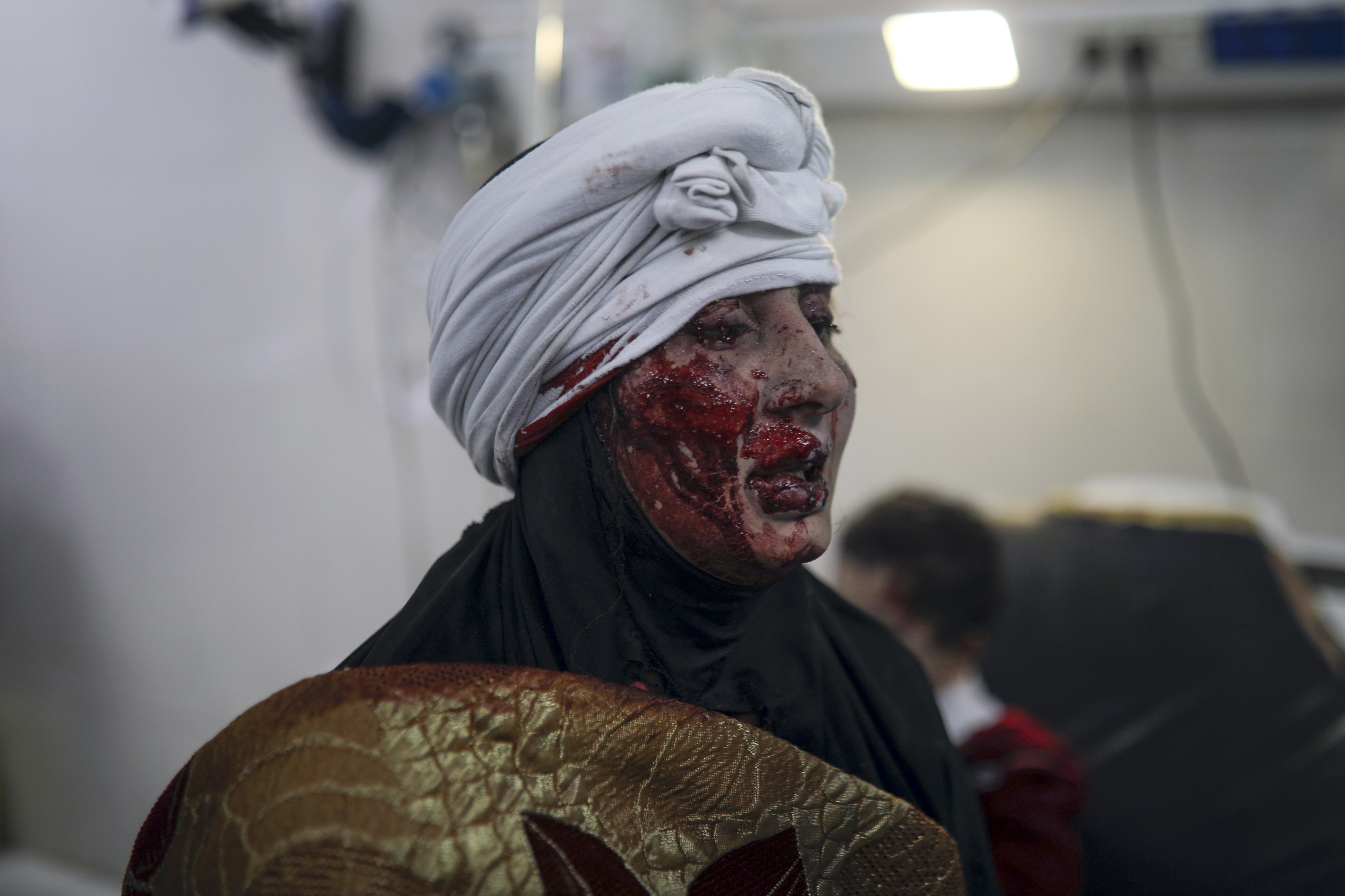 A wounded Palestinian woman receives medical treatment at the Nasser Hospital following an Israeli bombardment on Khan Younis refugee camp, southern Gaza Strip.