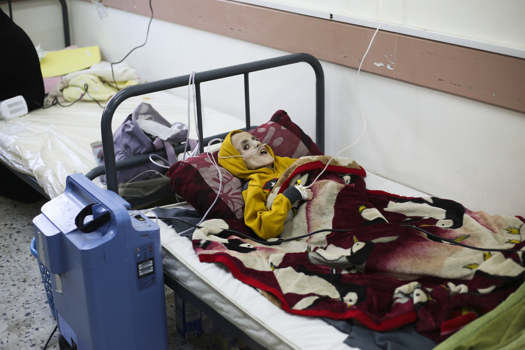 Ten-year-old Yazan al-Kafarna, born with cerebral palsy, lies at a hospital in Rafah, on March 3, 2024. Yazan died due to extreme muscle wastage caused primarily by a lack of food