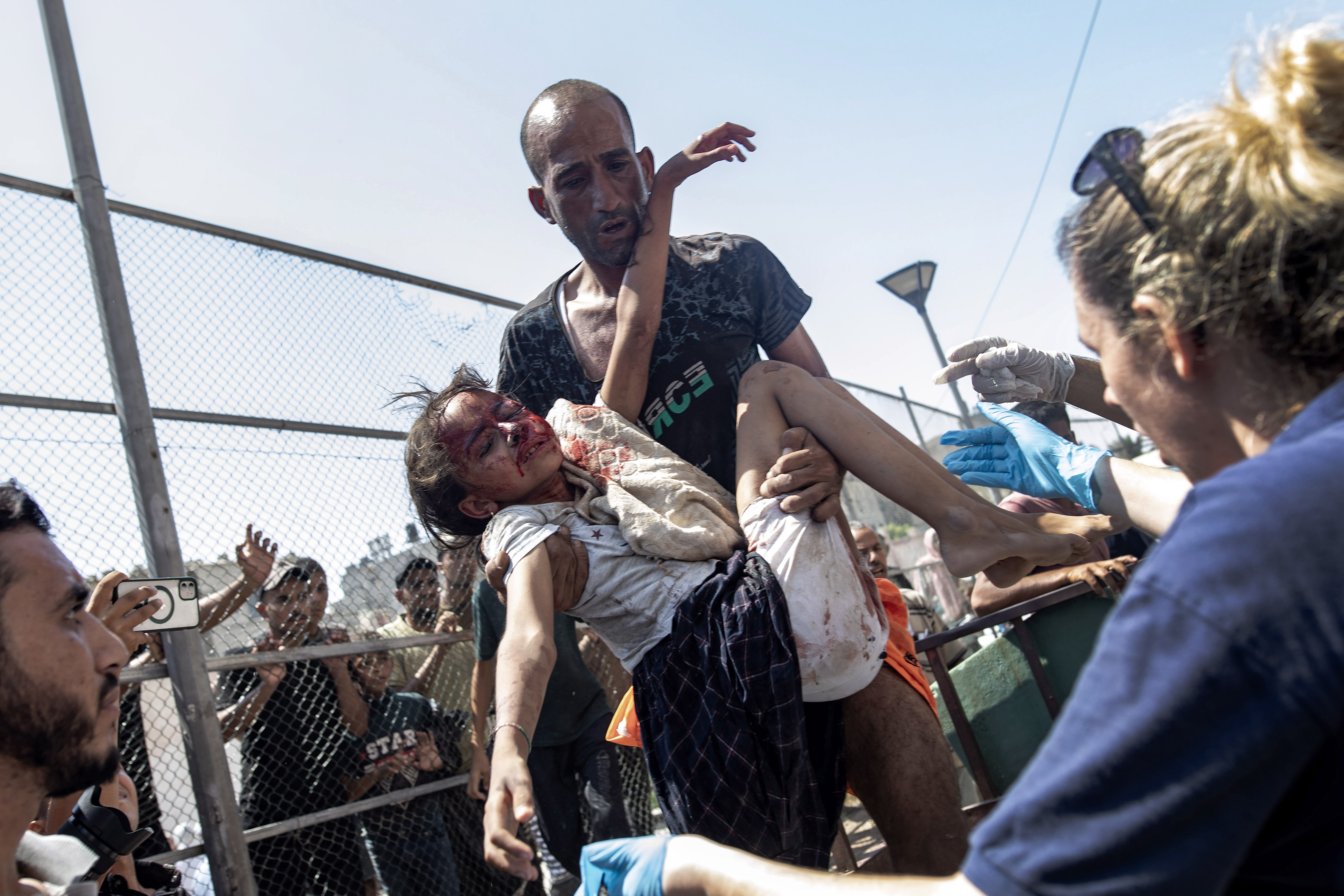 Palestinians injured in an Israeli strike east of Khan Younis arrive at the Nasser Hospital