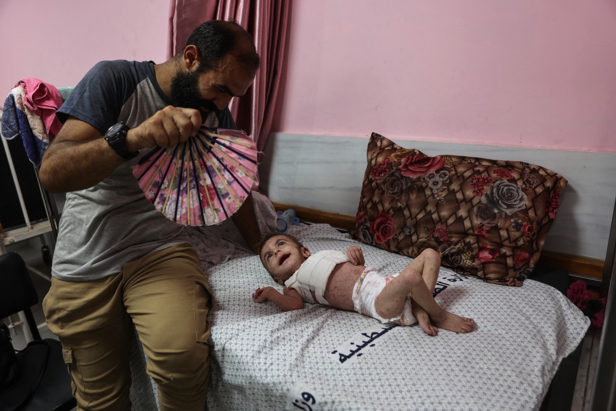Palestinian baby girl Wateen al-Adasi