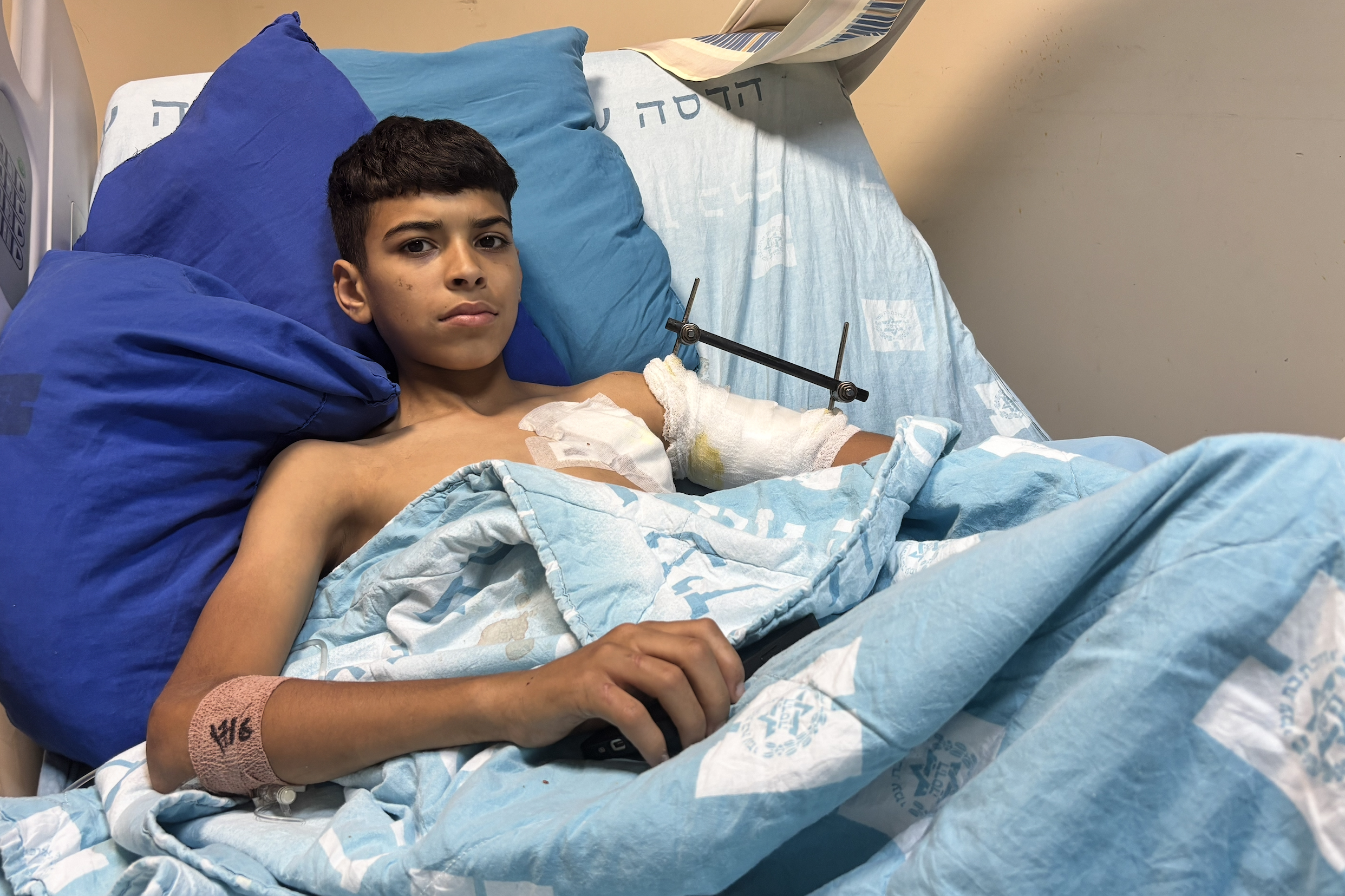 Iyas Abu Mufreh, 12, was shot by Israeli snipers during a family celebration in occupied East Jerusalem. The expanding ‘dumdum’ bullet narrowly missed his heart and caused severe damage to his shoulder, which the family fears may be permanently damaged [Al Jazeera]