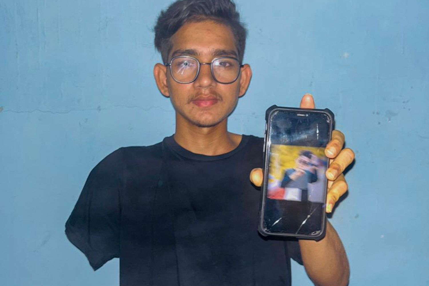 Atikul Gazi lost his arm after he was shot by police at point-blank range on August 5, 2024 [Courtesy of Atikul Gazi]