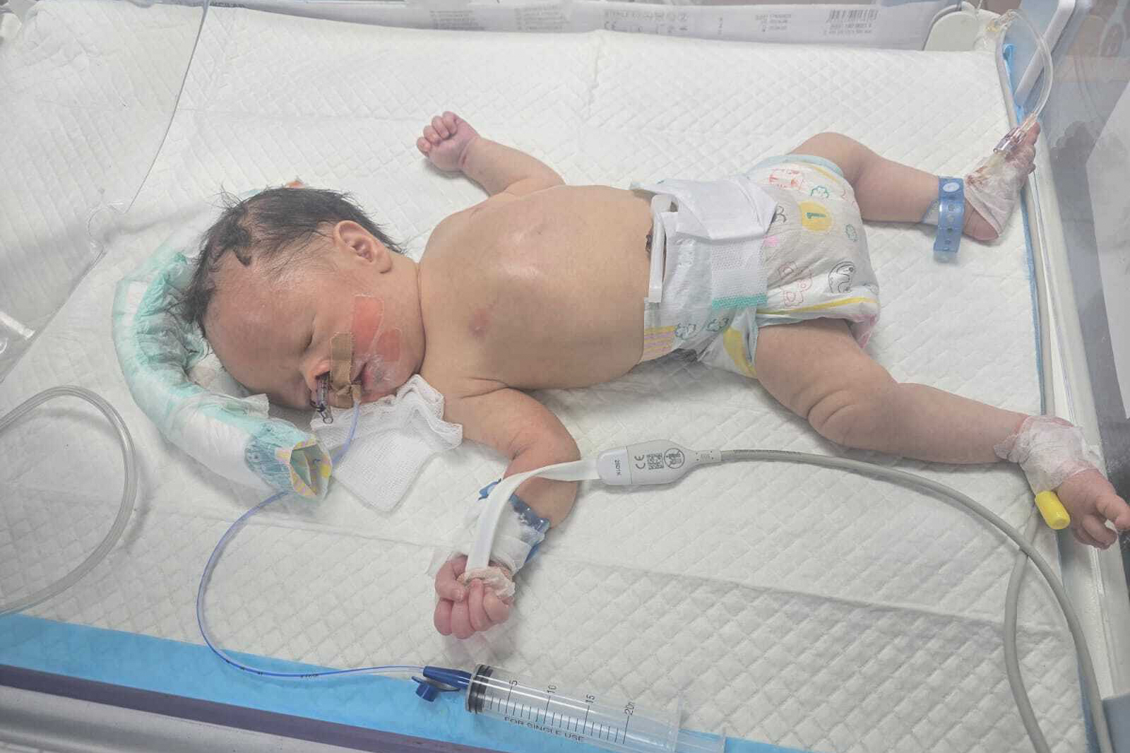 Baby Saleh, born prematurely after his mother slipped and went into labor during the settler attack, continues to fight for his life in a Ramallah intensive care unit.